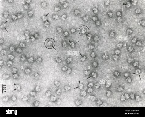 Ribosome Micrograph