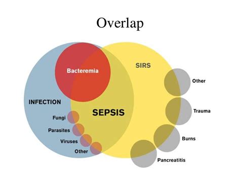 Surviving sepsis campaign highlights 2016