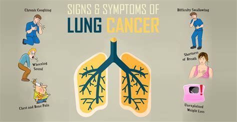 Lung Cancer Symptoms And Signs