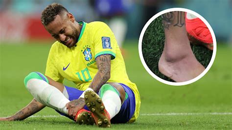 Neymar pictured with swollen ankle in huge World Cup injury scare for Brazil | Goal.com