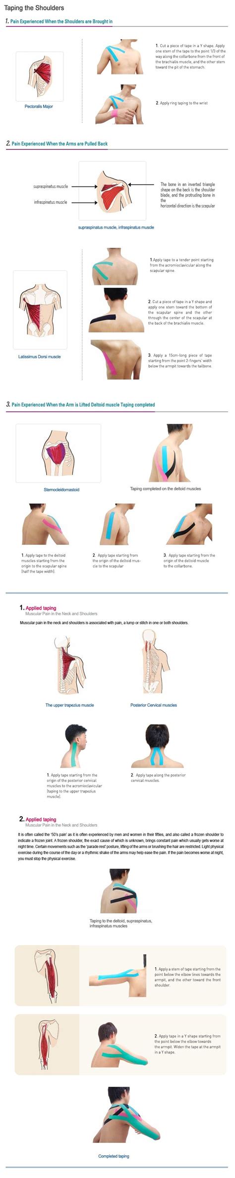 17 Best images about Kinesiology taping on Pinterest | Knee pain ...