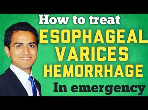 Esophageal Varices & Variceal Hemorrhage Treatment and Managment(STEP WISE APPROACH) - YouTube