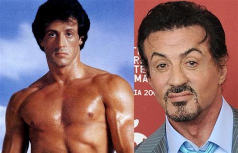 Celebrity Plastic Surgery - Before & After - Business Insider