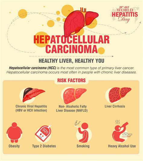 World Hepatitis Day - Hepatocellular Carcinoma Symptoms and Causes | Dr Lal PathLabs