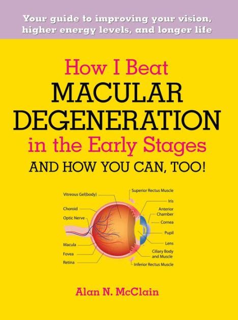 How I Beat Macular Degeneration in the Early Stages and How You Can, Too!: Your guide to ...