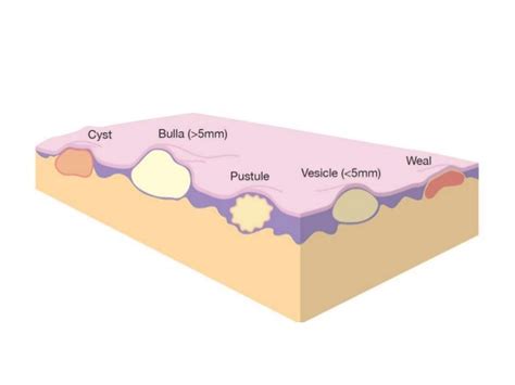 The Different Types Of Skin Inflammation | Heidi Salon