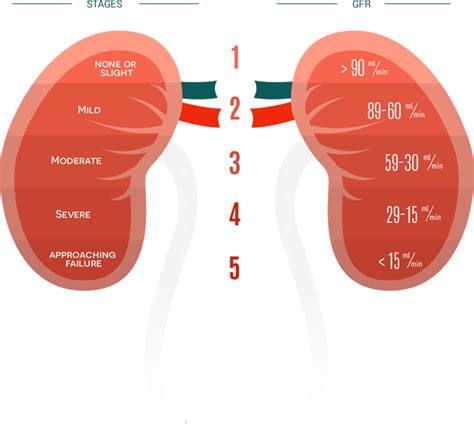 Kidney Disease Stages Chart | Labb by AG