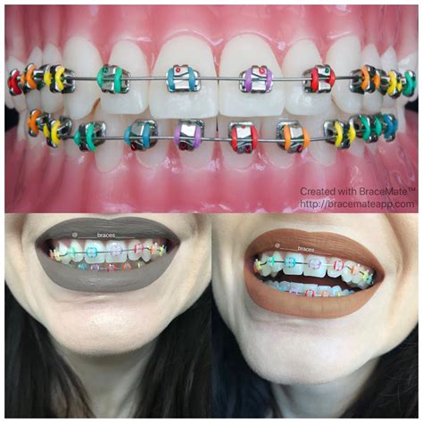 Braces color wheel braces color - mazbooster