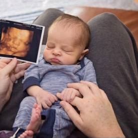 4D Ultrasound Houston | Images, Benefits, Cost & Locations Near Me