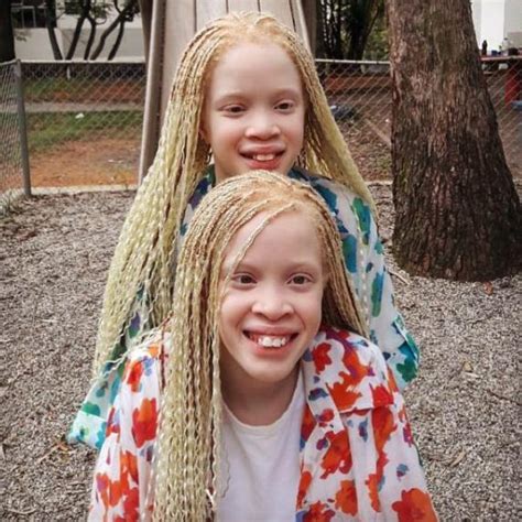 Albino twins of 11 years old shock the entire world. Here is what they ...