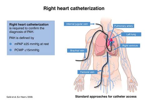 Pin on PAH HEALTH