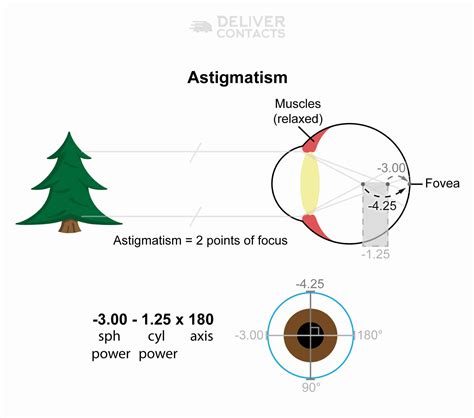 Vision Problems | Deliver Contacts