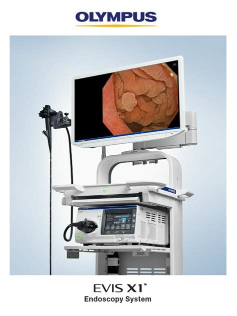 Olympus Announces Market Launch of EVIS X1™ Endoscopy System