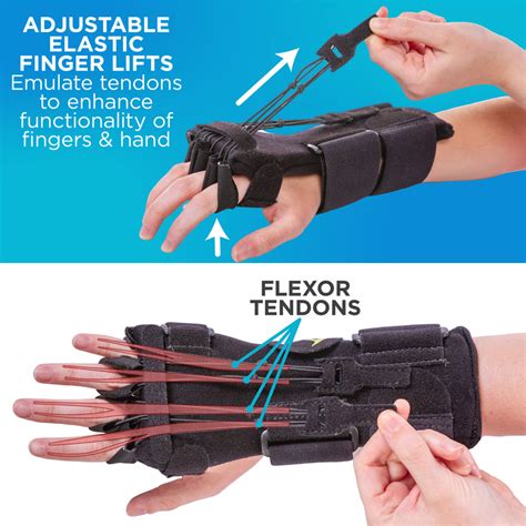 Radial Nerve Splint | Saturday Night Palsy Finger Extension Brace