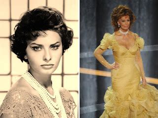 Sophia Loren Plastic Surgery Before and After Facelift and Breast Implants