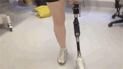 490 best Amputation | Prosthetics images on Pinterest | Prosthetic leg, Cyberpunk and Medical design