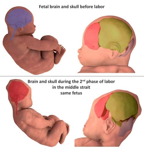 3D scans reveal how an infant's head changes shape during birth