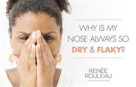 Your Dry Nose: How To Get The Skin To Stop Peeling | Dry skin on face, Dry nose, Dry skin patches