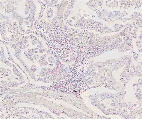 PD1 signaling products - Navinci