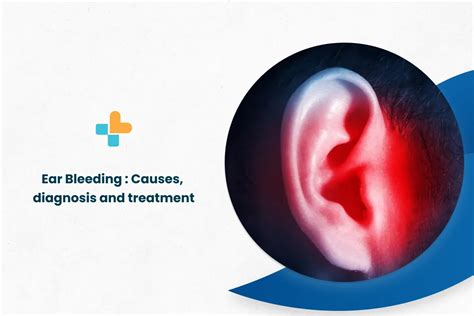 Ear Bleeding: Causes, Diagnosis, And Treatment | Ayu Health