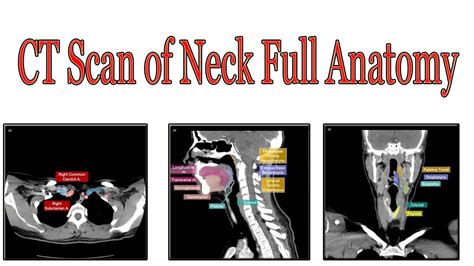 CT scan of neck axial full anatomy - YouTube