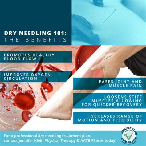 What is Dry Needling? | Physical Therapy in the Houston Heights