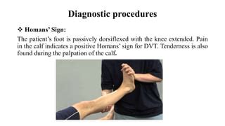 Deep Venous Thrombosis (DVT) | PPT