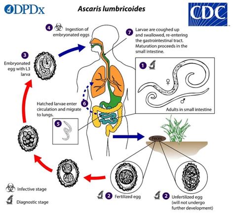 Ascaris lumbricoides- Life cycle, Pathogenicity, Clinical Manifestation