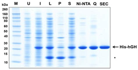 Polyacrylamide Gel Electrophoresis Page | Hot Sex Picture