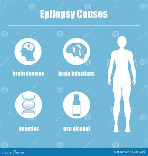 Epilepsy causes stock vector. Illustration of head, confusion - 158087237