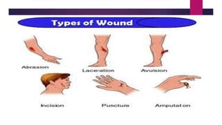 Types of wounds and management.