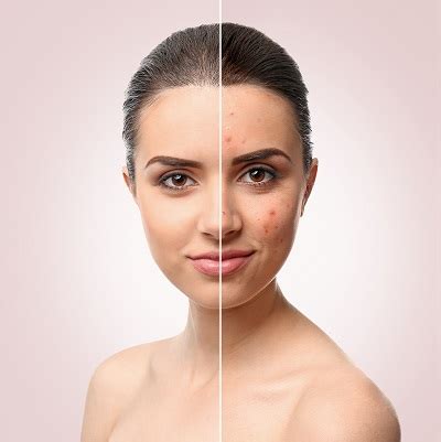 Dermatologist In Savannah, GA | Savannah Dermatology Clinic