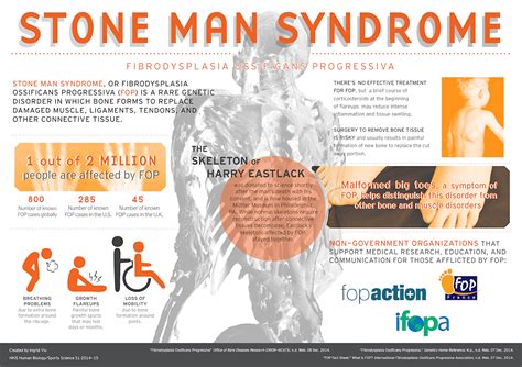 Fibrodysplasia Ossificans Progressiva/Stone Man Syndrome | Strive For Good Health