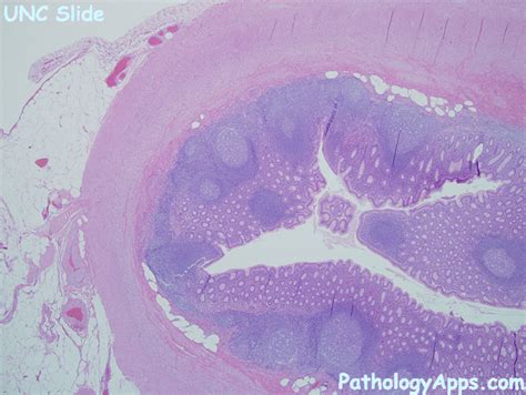 normal appendix histology