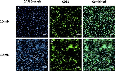 Fluorescent immunostaining for endothelial genetic marker CD31 ...