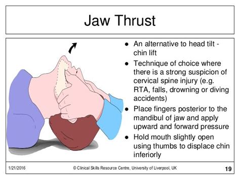 Jaw Thrust | Emt study, Emergency nursing, Nursing school humor