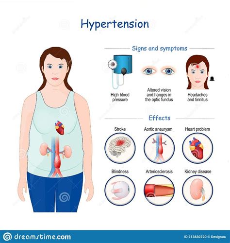 Hypertension. Signs, Symptoms, And Effects Of High Blood Pressure Stock Illustration ...