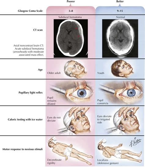 Coma, Vegetative State, Brain Death, and Increased Intracranial Pressure | Neupsy Key