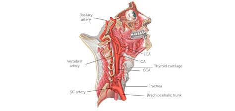 Vertebral Carotid Duplex Scan