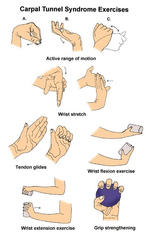 Carpal Tunnel Syndrome | ReLiva Physiotherapy & Rehab