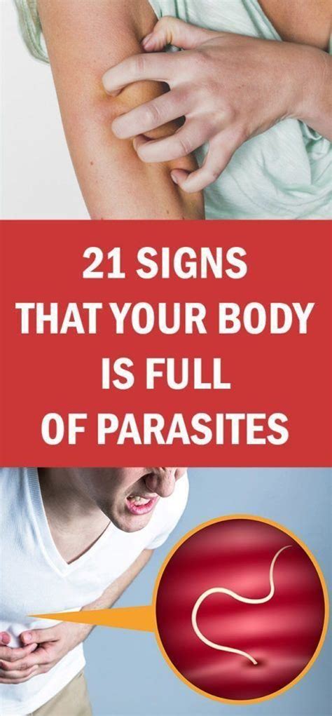 21 Signs That Your Body is Full of Parasites!!!! | Body, Parasite, How ...