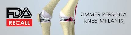 FiDA Failed Implant Device Alliance: Zimmer Persona Knee Revision Surgery Prompts Recall