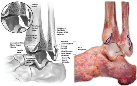 Anatomy 101: Ankle Syndesmosis - Distal Tibiofibular Joint — Rayner & Smale