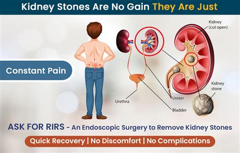 Kidney Pain Location