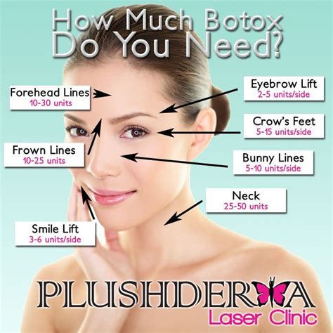 Image result for botox injection sites diagram in 2019 | Botox injection sites, Botox injections ...