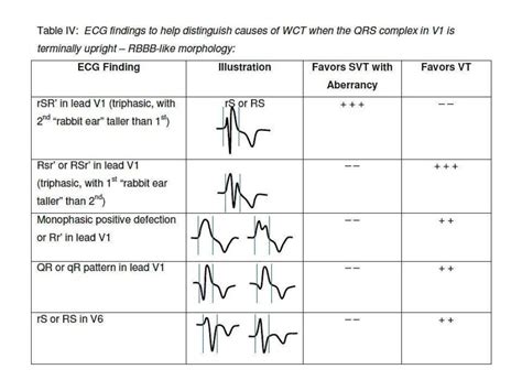 Differential Diagnosis of Wide QRS Complex Tachycardias - The Cardiology Advisor