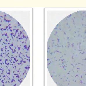 Antibiotic susceptibility of the Pediococcus acidilactici. | Download Scientific Diagram