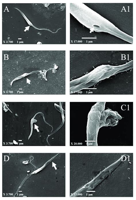 Morphological alterations in T. cruzi after compound treatment analyzed... | Download Scientific ...