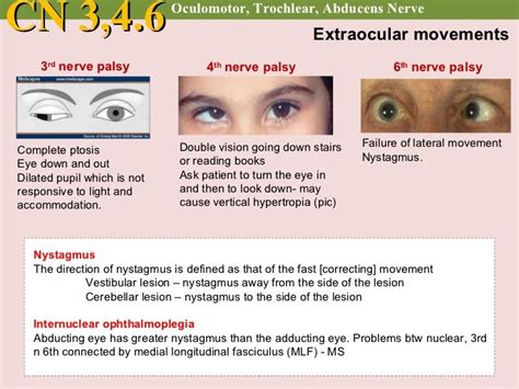 Cranial nerve examination