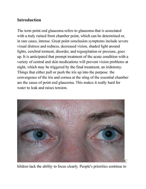 Anisocoria and effects - Introduction The term point end glaucoma refers to glaucoma that is ...